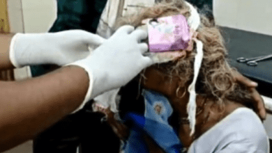 Head Wound Dressed With Condom Pack At Madhya Pradesh Health Centre