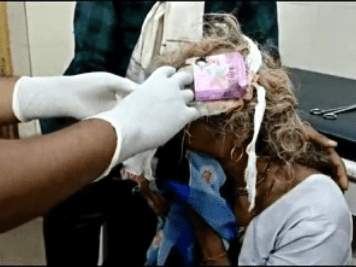 Head Wound Dressed With Condom Pack At Madhya Pradesh Health Centre