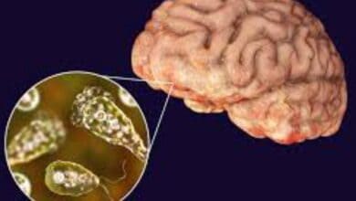 36-year-old Israeli man dies from rare brain-eating amoeba