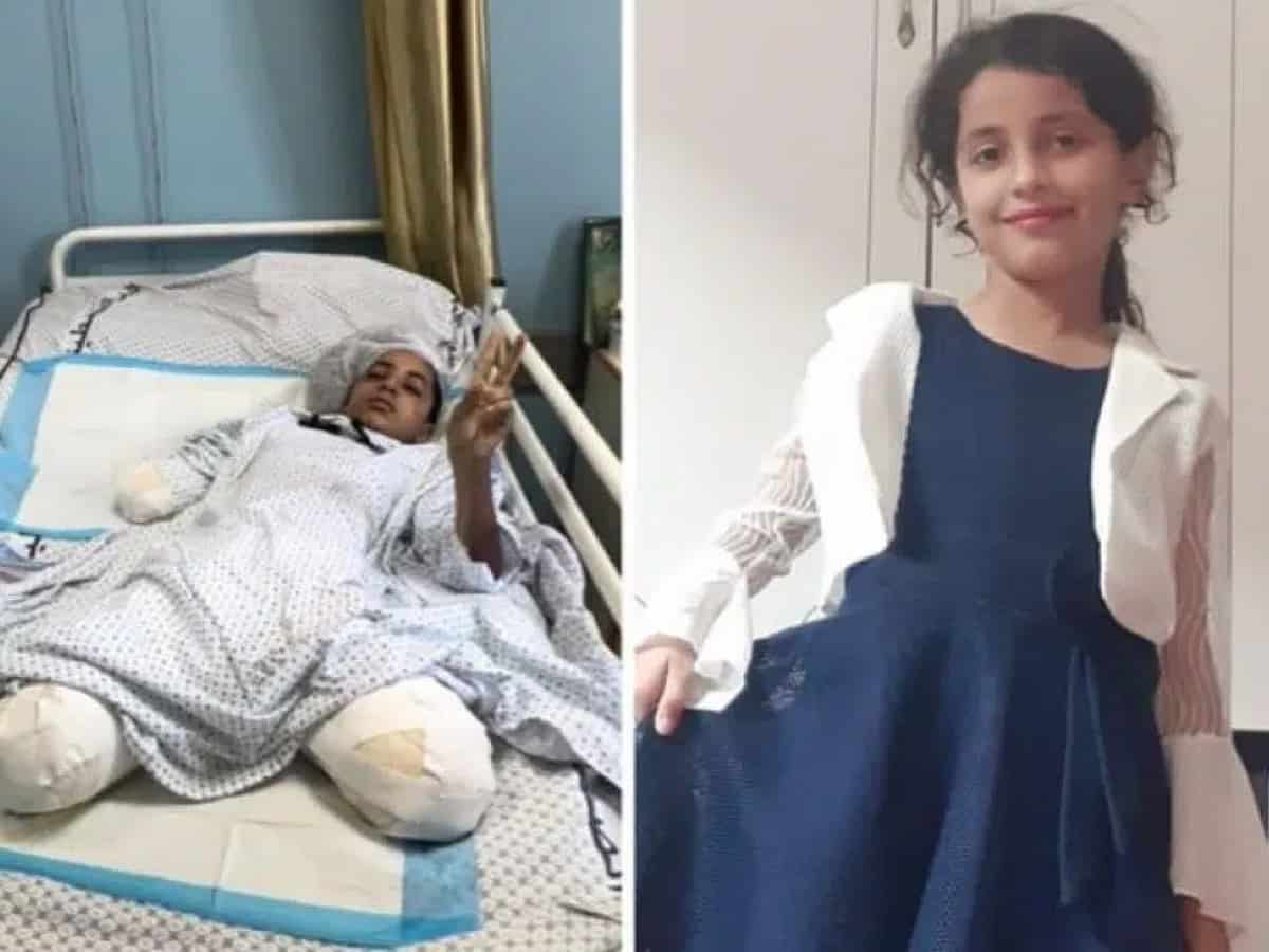 11-year-old Palestinian girl injured in Israeli attack to receive treatment in Turkiye