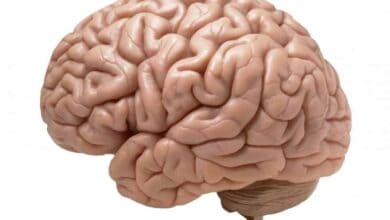 New AI algorithm can detect brain abnormality, help cure epilepsy