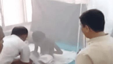 Class 2 student has suffered 40 per cent burn after a teacher threw hot water