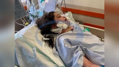 22-year-old Iranian woman dies after being beaten into a coma by police for ‘improper hijab’