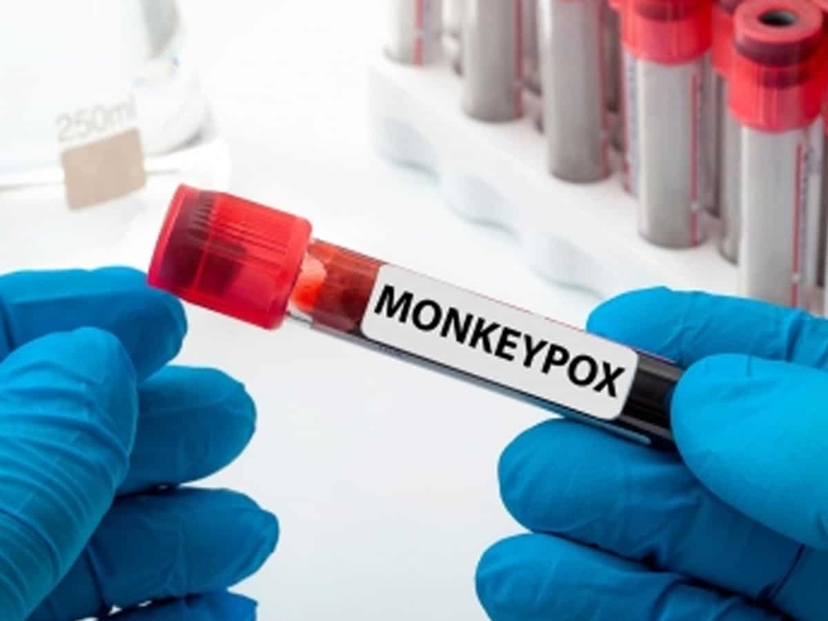 Canada confirms 1,321 monkeypox cases