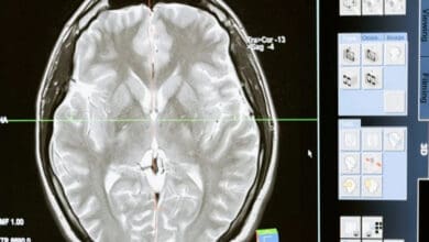 Adult brain has ability to recover vision: New research