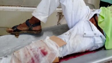 MP Shocker: Cardboard as makeshift plaster on fractured leg