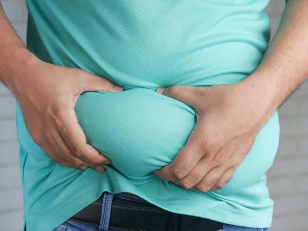New guidelines for weight loss surgery