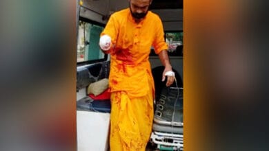 Uttar Pradesh: Seer chops off palm as offering in Ayodhya