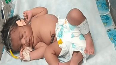 Woman gives birth to baby girl with 'four' legs in MP's Gwalior