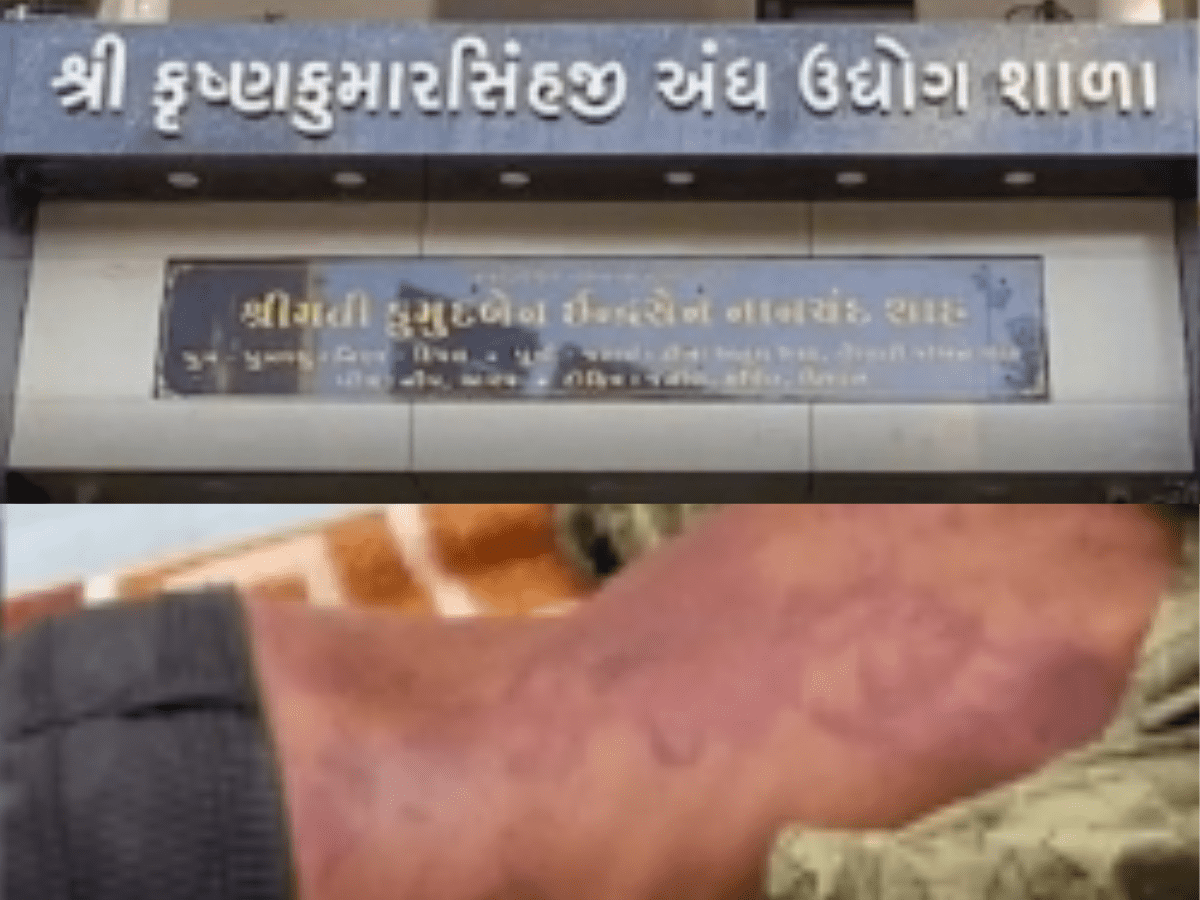 Gujarat: 2 blind school students suspended for beating classmates