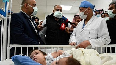 Saudi Arabia: 11-hour surgery to separate Iraqi conjoined twins begins