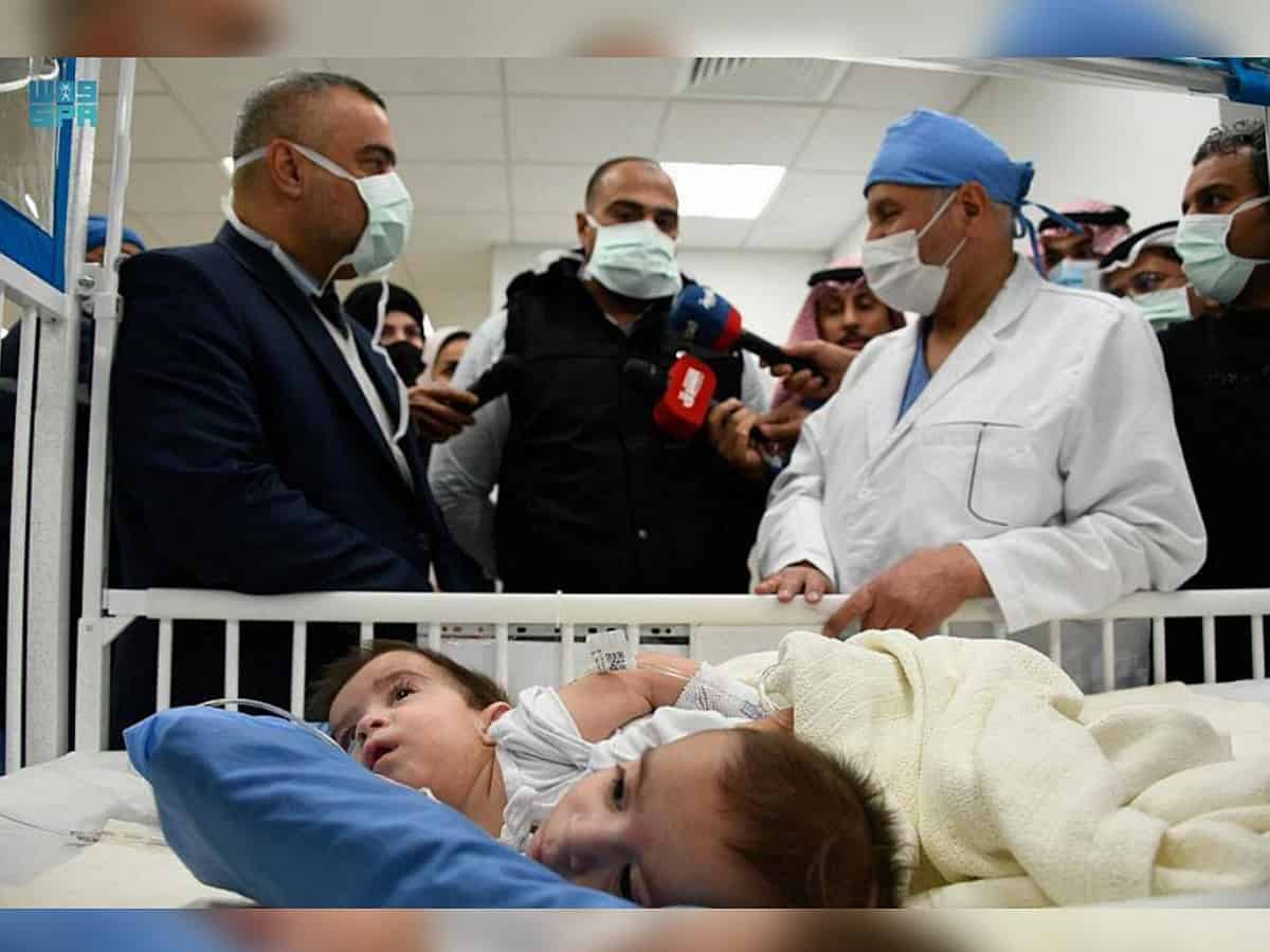 Saudi Arabia: 11-hour surgery to separate Iraqi conjoined twins begins