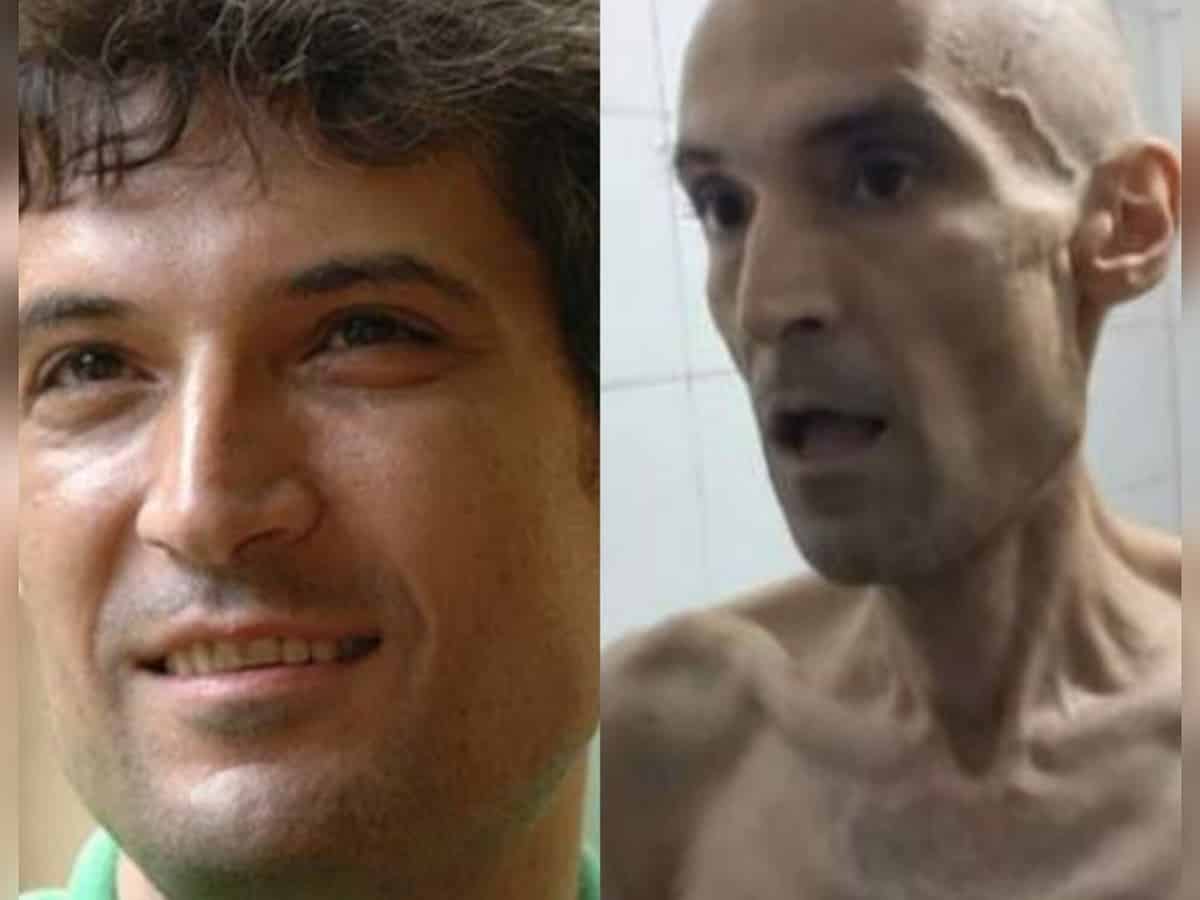 Shocking images of emaciated Iranian prisoner on hunger strike