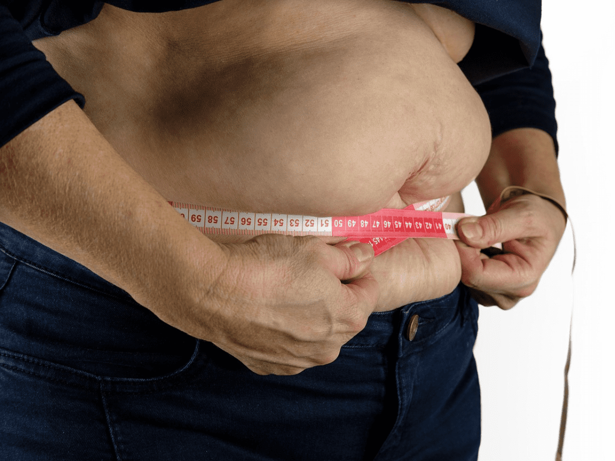 Obesity is challenge for economic progress of India: Docs in Hyderabad