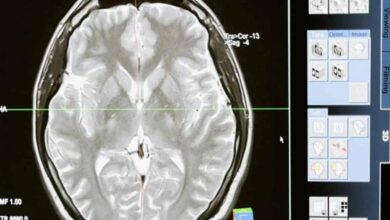 High BP in men in their 30s linked with dementia risk in their 70s