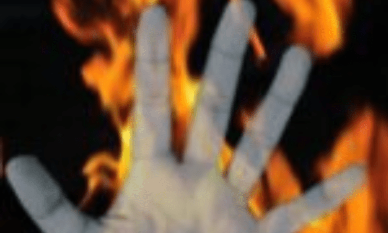 Newly-married woman found with burn injuries on highway in UP