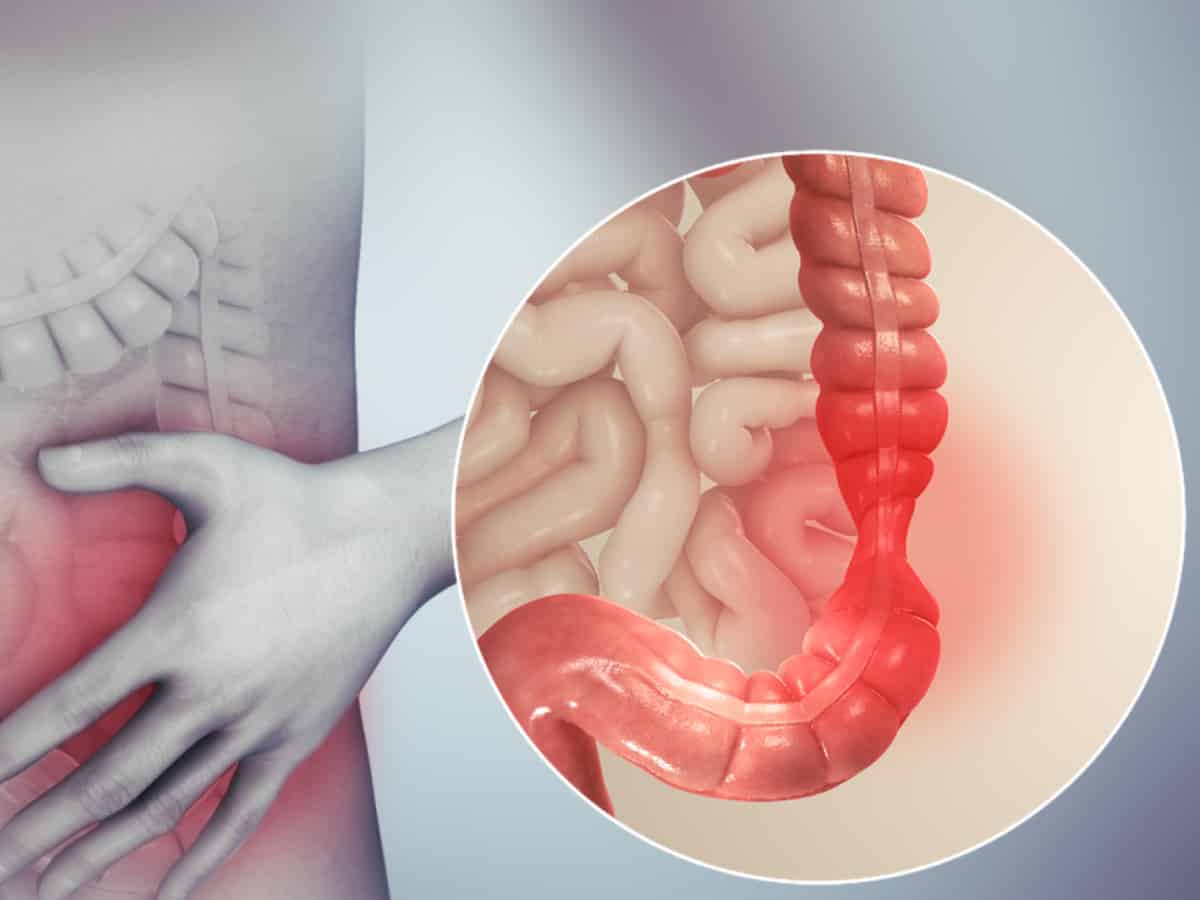 Study finds common sleep hormone pill can worsen bowel inflammation