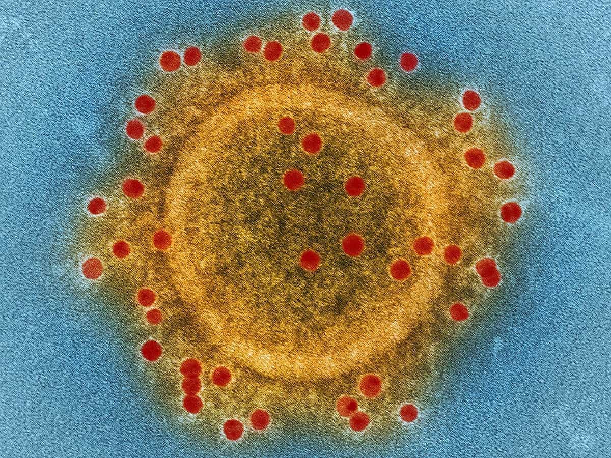 28-year-old man tests positive for MERS-CoV in Abu Dhabi