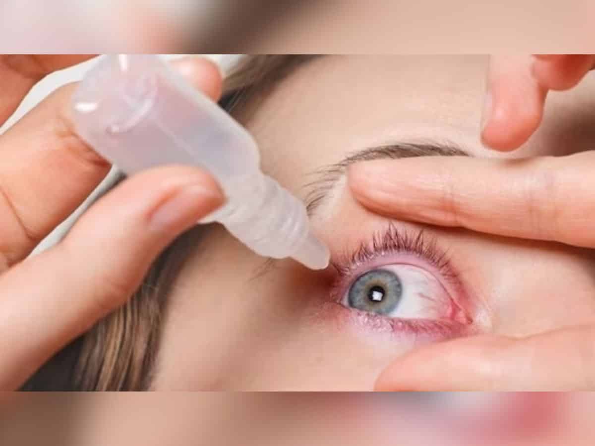 Conjunctivitis soaring in Hyderabad: Tips to prevent pink eye