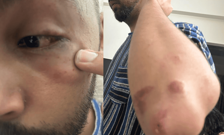 Andhra ex-DGP’s son, another youth fight over a girl in pub