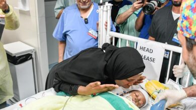 Saudi: Tanzanian conjoined twins successfully separated in 16-hr surgery