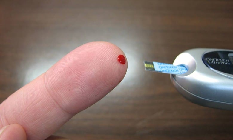AI-driven dataset to reveal new insights around diabetes