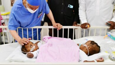 Saudi Arabia begins 14-hr surgery to separate Nigerian conjoined twins