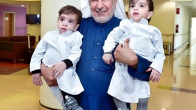 Saudi doctor meets Iraqi conjoined twins one year after their separation