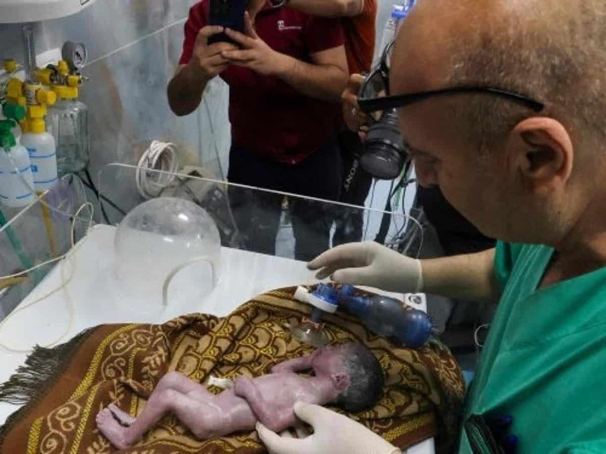 Gaza doctors save baby from mother's womb who was killed in Israeli strike