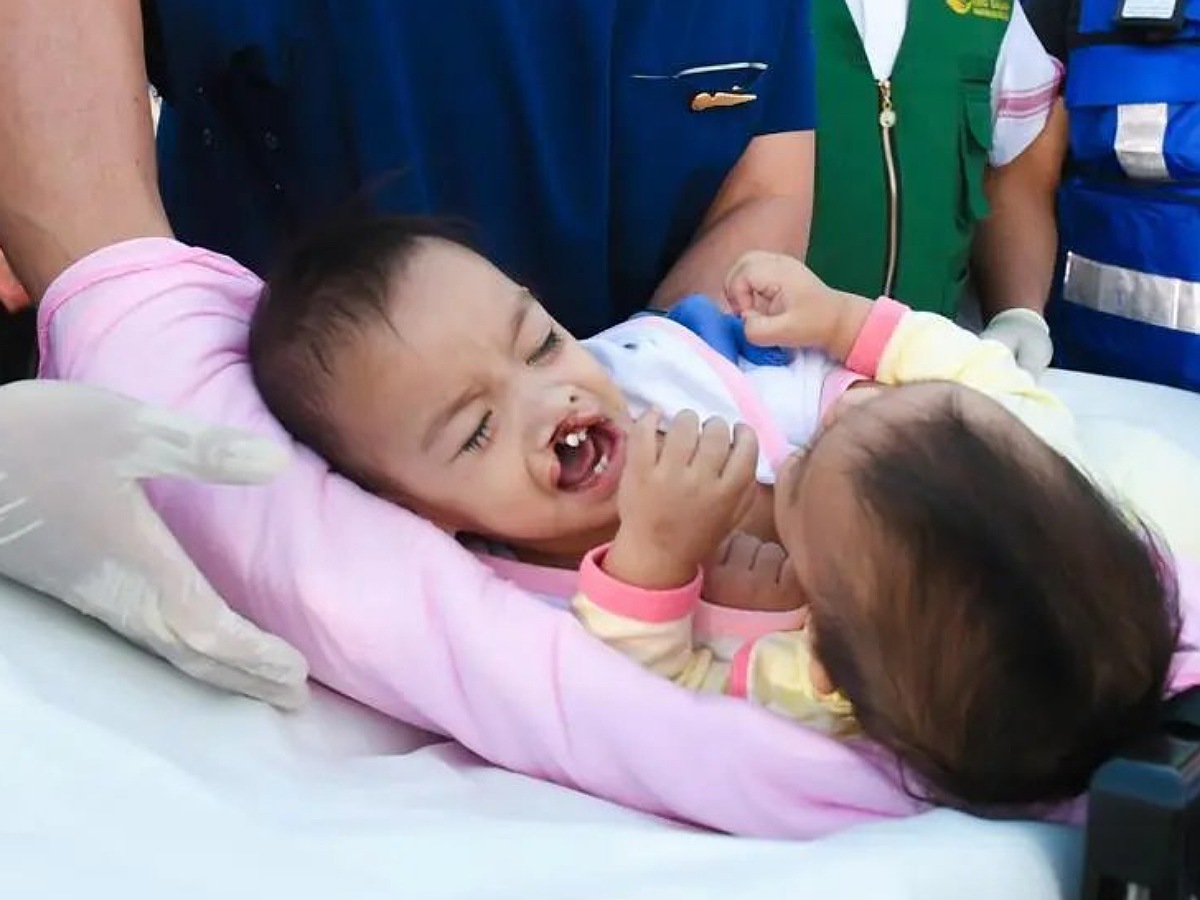 Riyadh: Filipino conjoined twins Akhizah and Ayeesha Yusoph arrived in the Kingdom of Saudi Arabia’s capital Riyadh on Sunday, May 5, accompanied by their mother and grandmother for separation surgery. The 16-month-old twins, who share a liver, arrived at King Khalid International Airport via a medical air-evacuation plane. They were taken to the King Abdullah Specialist Hospital (KASH) for Pediatrics at the Ministry of the National Guard for medical examination and potential surgical separation. https://twitter.com/SBAgovSA/status/1787162573088985169?t=TZEZ88cBXuDiHHHlyxji4A&s=19 The initiative came after the directives of the Custodian of the Two Holy Mosques, King Salman bin Abdulaziz Al-Saud, and Prince Mohammed bin Salman bin Abdulaziz Al-Saud, Crown Prince and Prime Minister of Saudi Arabia. Dr. Abdullah Al-Rabeeah, advisor at the Royal Court and General Supervisor of King Salman Humanitarian Aid and Relief Centre (KSRelief), expressed gratitude for the Saudi Conjoined Twins Program's support, the Saudi Press Agency (SPA) reported. Akhizah and Ayeesha's parents expressed gratitude to the Custodian of the Two Holy Mosques and the Crown Prince for their warm welcome and hospitality upon their arrival in the Kingdom. https://twitter.com/alekhbariyatv/status/1787151234719187442?t=ItxhOep9DkFW-0l5G16vXA&s=19 https://twitter.com/alekhbariyatv/status/1787185438324646180?t=ugghpRcj0WOotPkmn2mTgw&s=19