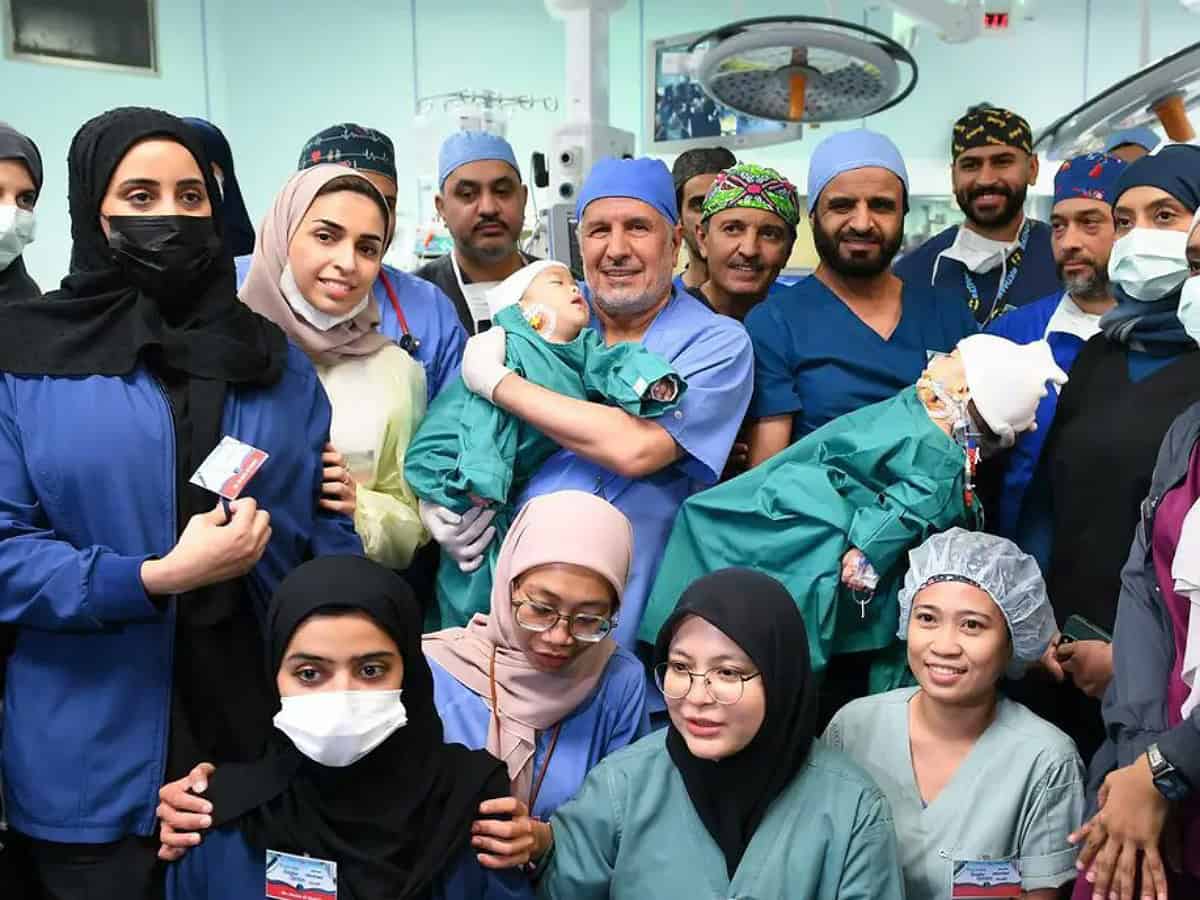 New lease on life: Filipino conjoined twins successfully separated in Riyadh