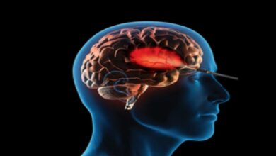 'Aggression, confusion, altered behaviour may signal brain tumour risk'