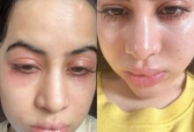 Uorfi Javed facing serious health issue? Her new pics shock fans