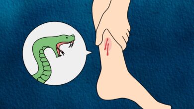 Residential school student bitten by snake, BRS slams Telangana govt