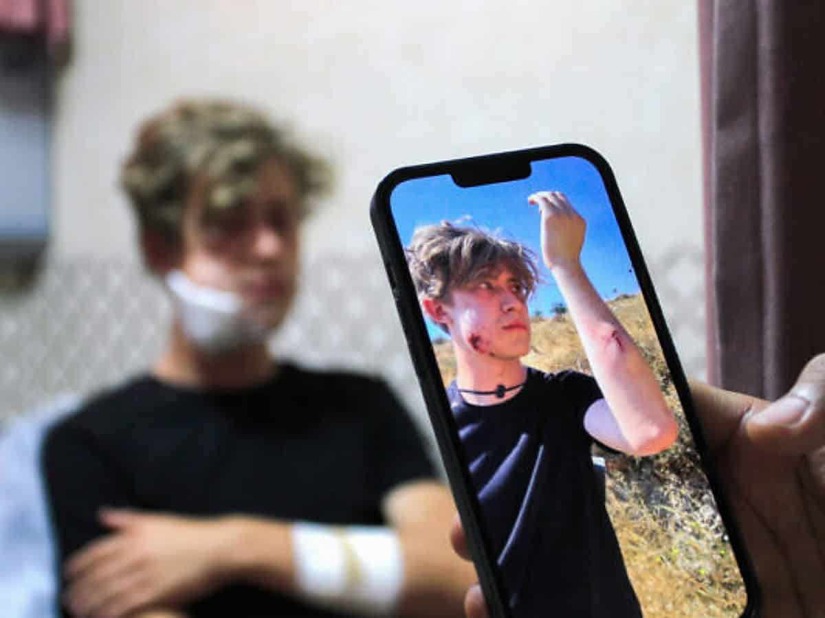 Israeli settlers injure 3 foreign pro-Palestinian activists in West Bank