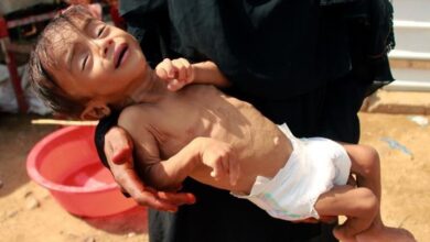 Spike in child malnutrition across Yemen's gov't-controlled areas: UN