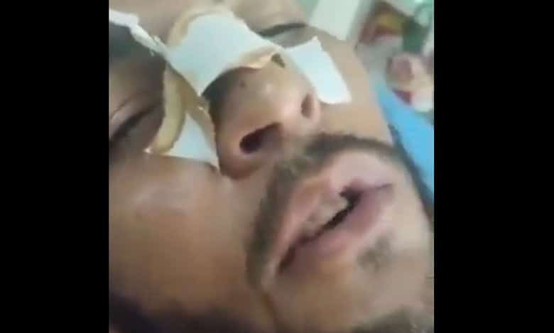 UP: Video of man being assaulted in Pilibhit goes viral, 15 booked