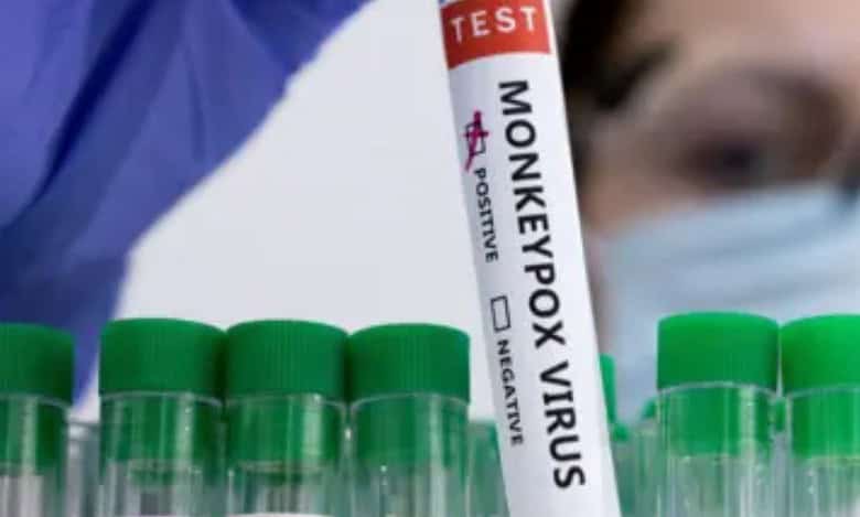 Centre advises states to screen, test all suspect mpox cases