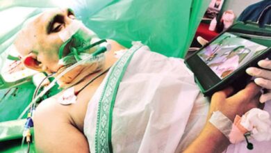 Active brain surgery