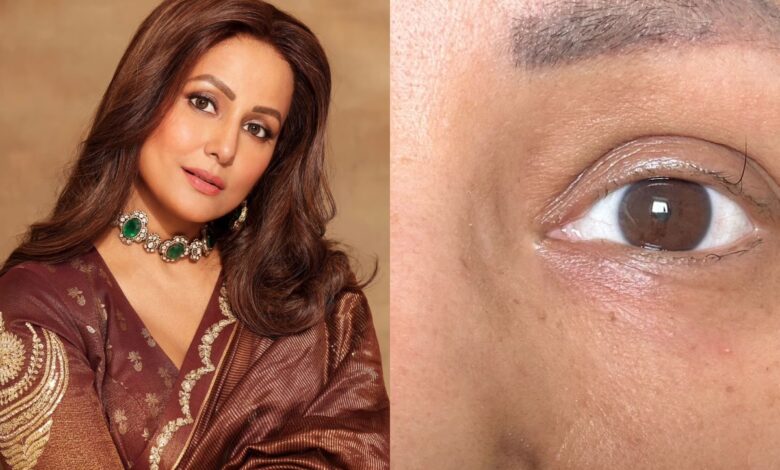 Hina Khan shares picture of her ‘single eyelash’, call it her ‘motivation’