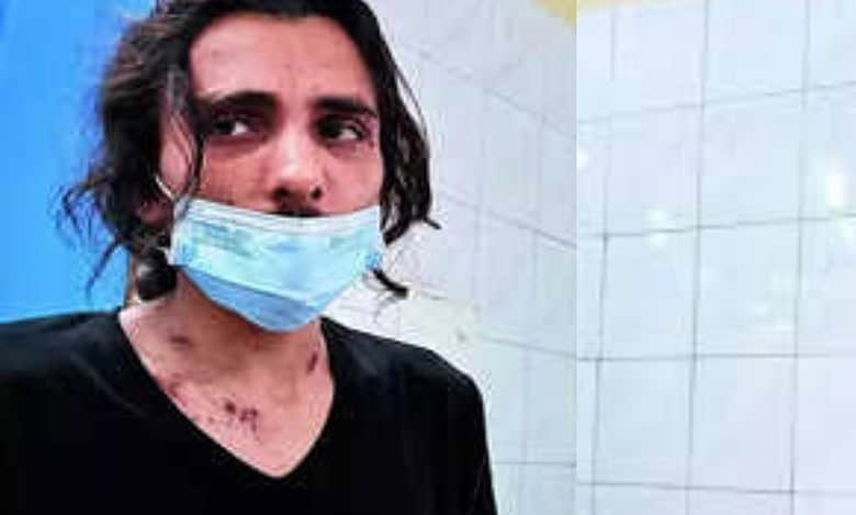 Syrian refugee, infant son attacked with ‘acid’ in Delhi; 1 held