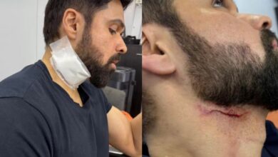 Emraan Hashmi injured on sets of 'Goodachari 2' in Hyderabad
