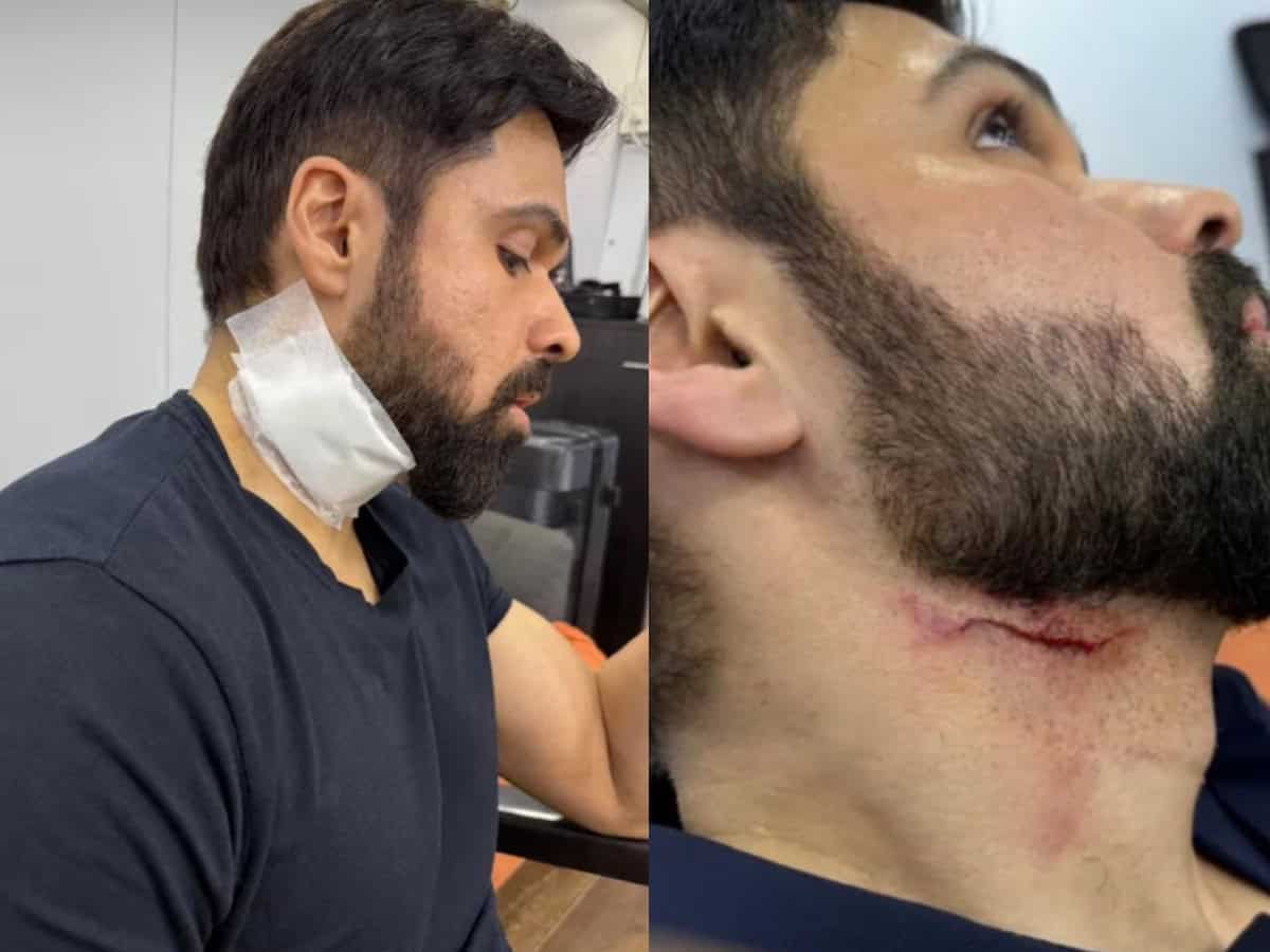 Emraan Hashmi injured on sets of 'Goodachari 2' in Hyderabad