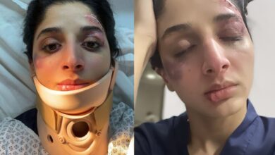 Pakistani actress Mawra Hocane’s disturbing injury pics go viral
