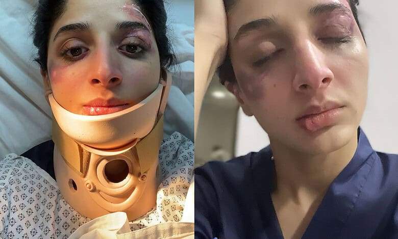 Pakistani actress Mawra Hocane’s disturbing injury pics go viral
