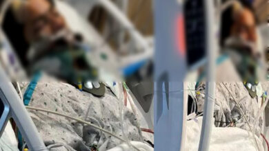 Hyderabad student in US hospital after severe accident in Philadelphia