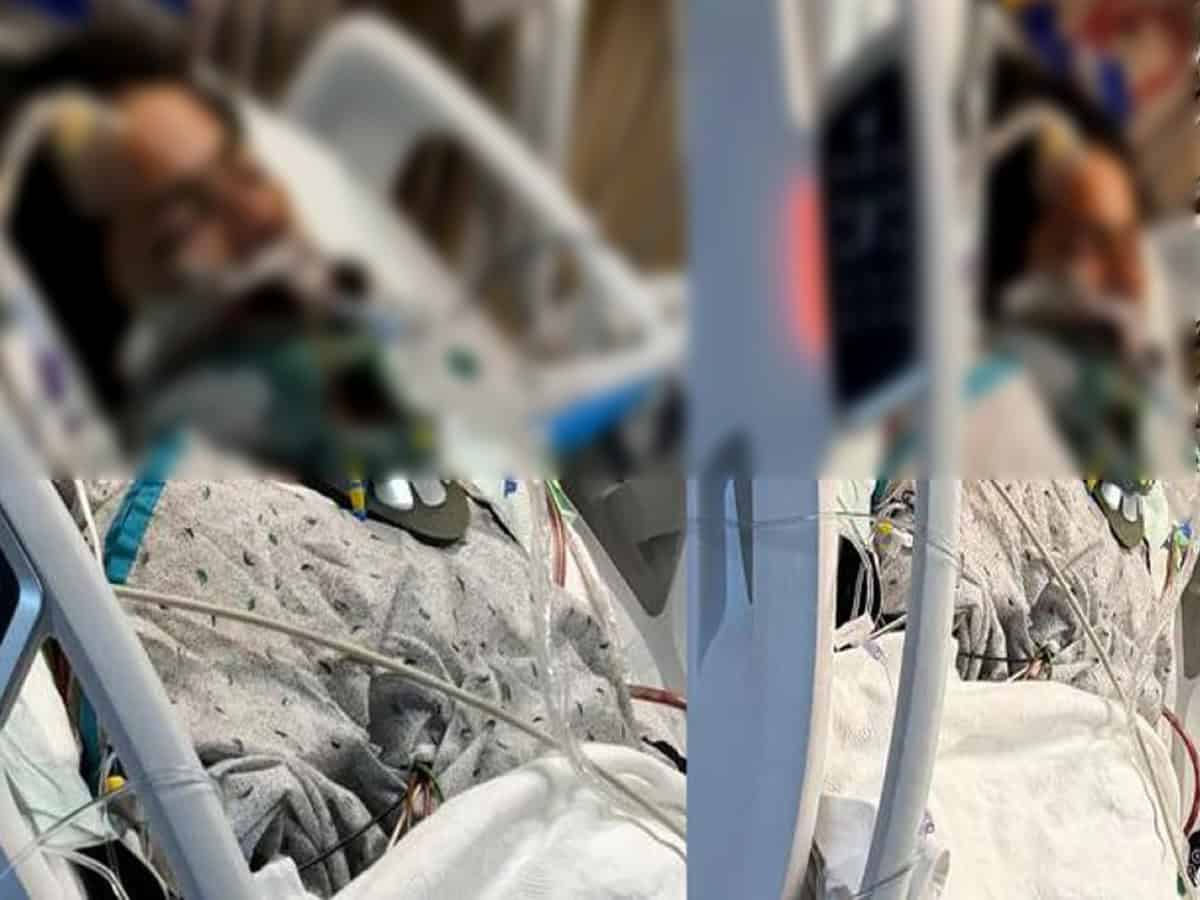 Hyderabad student in US hospital after severe accident in Philadelphia