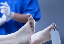 Representational Image of body sent for postmortem