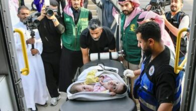 Watch: Syrian conjoined twins 'Celine and Eleen' arrive in Saudi Arabia