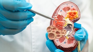 7 more arrested in Hyderabad kidney transplant racket case
